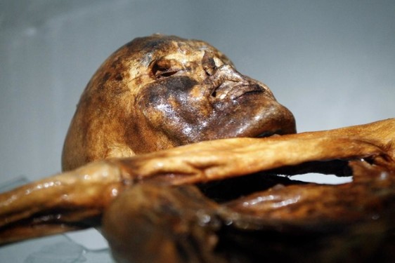 最新研究表明：5千年前的冰人木乃伊已携带HPV病毒